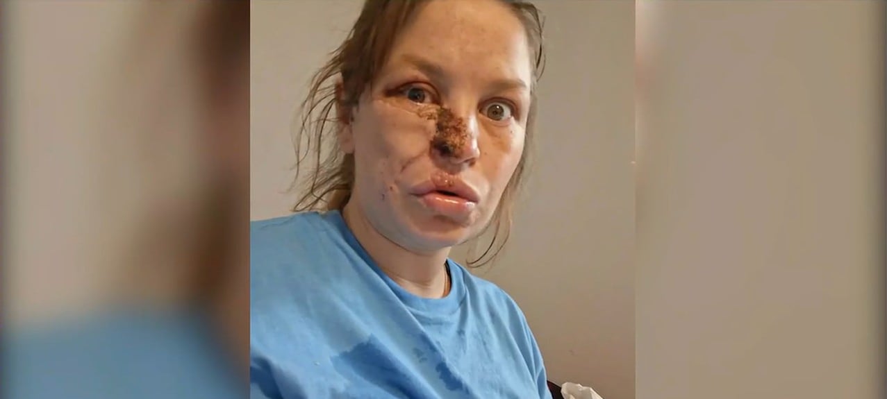 Pregnant Woman Recovers After Severe Dog Attack in Topeka