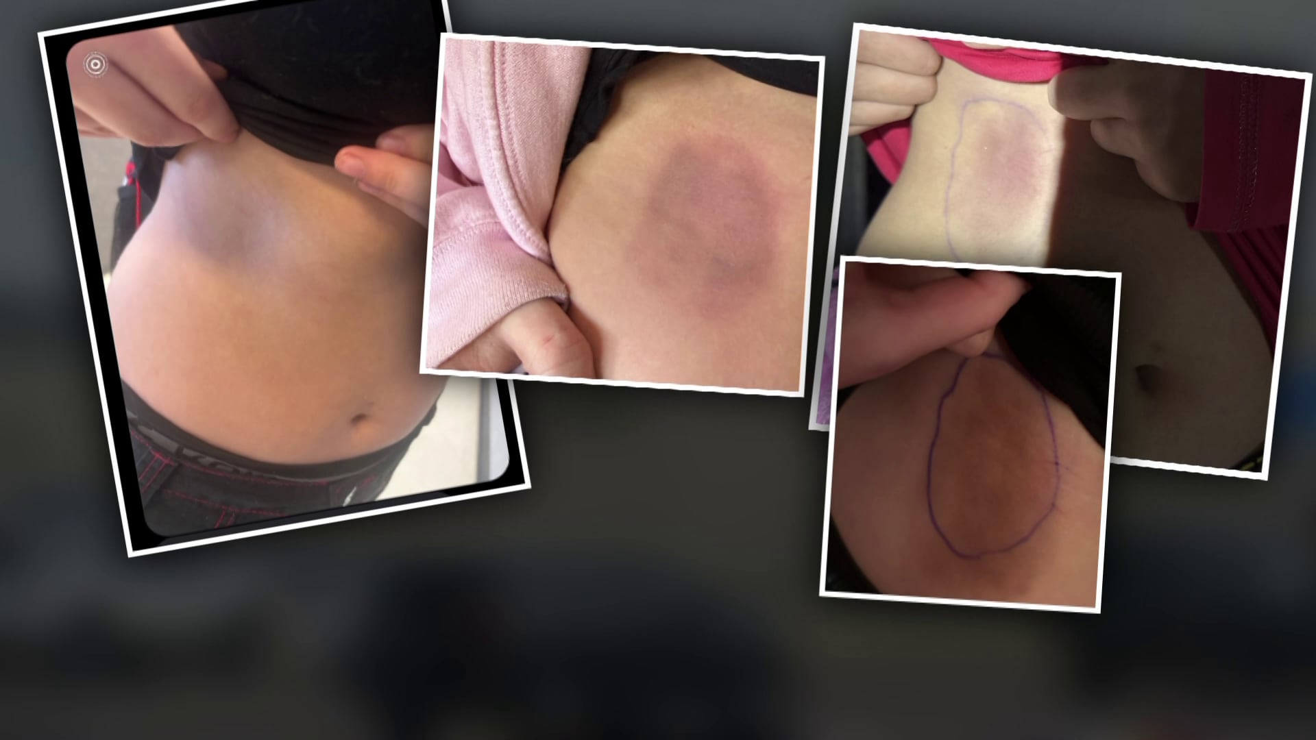 Arizona Teen Charged with Assault After Dodgeball Incident