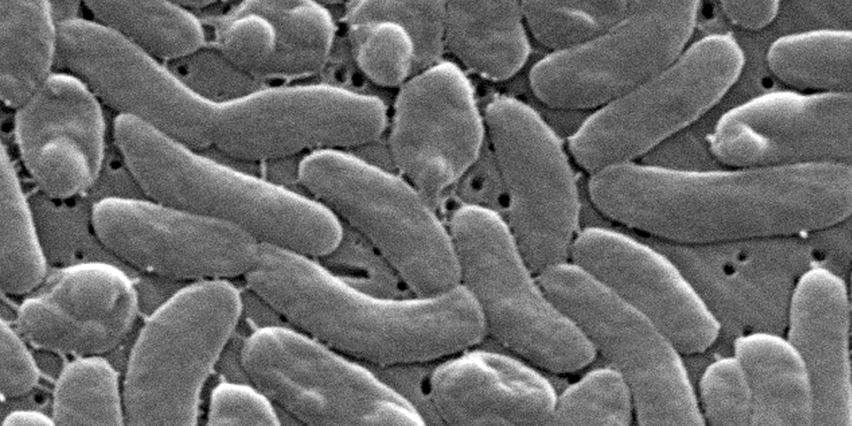 5 dead, 9 hospitalized from flesh-eating bacteria outbreak, health officials say
